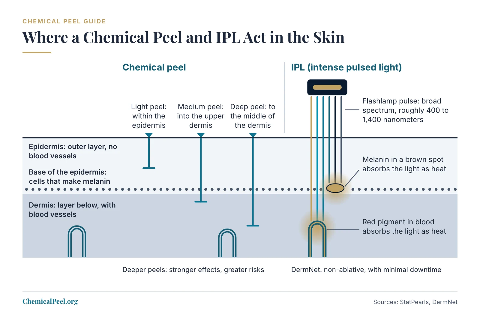 A skin cross-section shows a chemical peel acting from the surface down, with light peels staying in the epidermis, medium peels reaching the upper dermis and deep peels reaching the middle of the dermis. Beside it, IPL light passes into the skin, where melanin in a brown spot at the base of the epidermis and the red pigment in blood vessels in the dermis absorb it as heat.