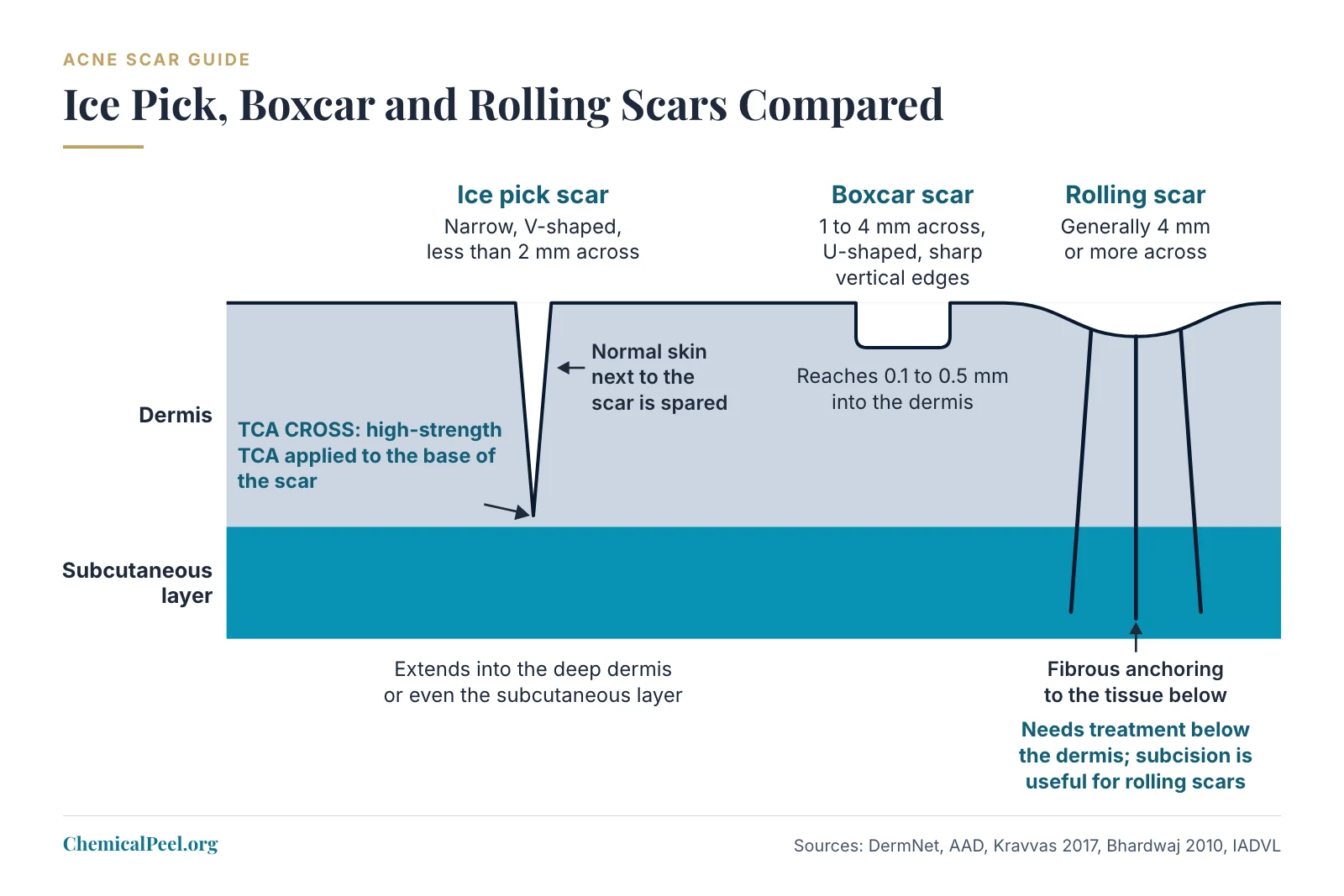 Cross-section of skin comparing three acne scars: a narrow, V-shaped ice pick scar under 2 mm across that reaches the deep dermis or subcutaneous layer, where TCA CROSS places high-strength TCA at the scar base; a 1 to 4 mm U-shaped boxcar scar 0.1 to 0.5 mm deep; and a rolling scar generally 4 mm or more across, anchored by fibrous bands to the tissue below.