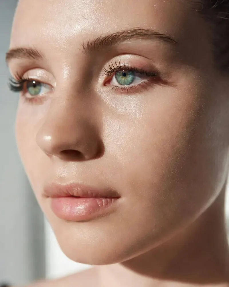 Woman in her mid-20s with clear skin following a preventive AHA chemical peel regimen for acne management.