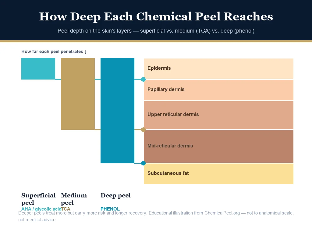 Diagram comparing how deep a phenol peel and a TCA peel reach in the skin layers