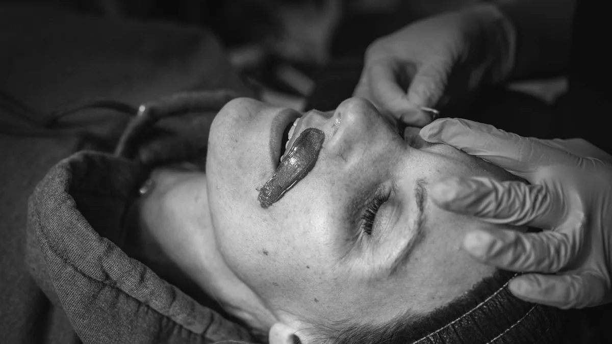 Featured image for “Phenol Peel: The Complete Guide to the Deepest Chemical Peel”